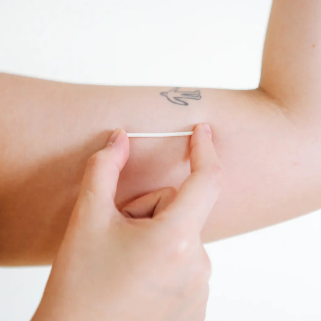 Implanon_Intradermal_Implant_Insertion